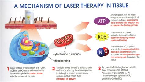 LLLT Laser Therapy | Biostimulation | Masterpiece Smiles