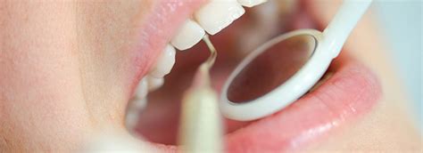 Periodontal Curettage Procedure - Open & Closed Curettage