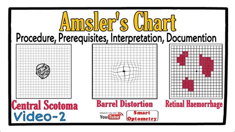 Amsler's Chart- Procedure, Prerequisites, Scotoma, Interpretation ...