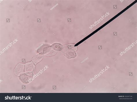 Renal Epithelial Cells Stock Photo 332267144 : Shutterstock