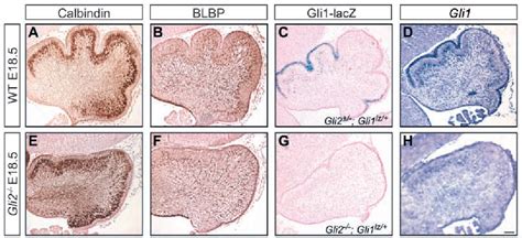 cerebellum development | Semantic Scholar