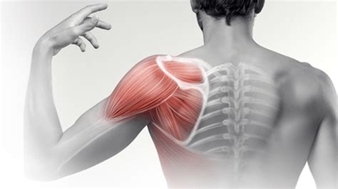 Rotator Cuff Tear And Surgery | IMove Physiotherapy