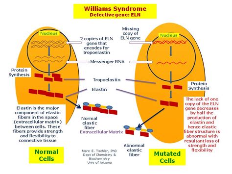 Williams Syndrome | Hereditary Ocular Diseases