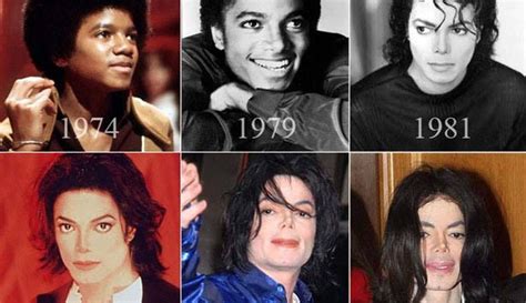 The Unforgettable Michael Jackson Before and After Plastic Surgery ...