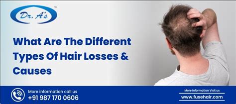 What Are The Different Types Of Hair Losses And Causes - FuseHair