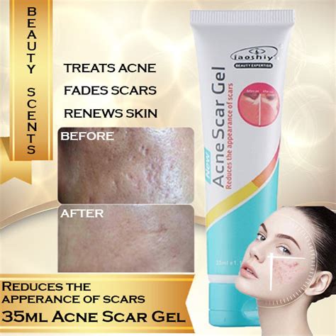 Acne Scar Gel - Reduces Appearance of Scars - 35ml | Lazada PH