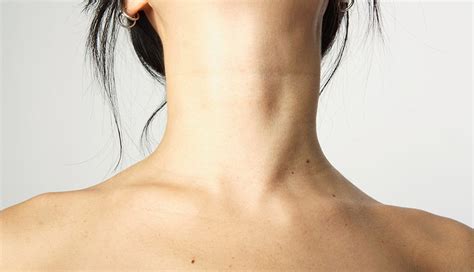 Thyroid-neck-rash-treatment - Trending 582cqw