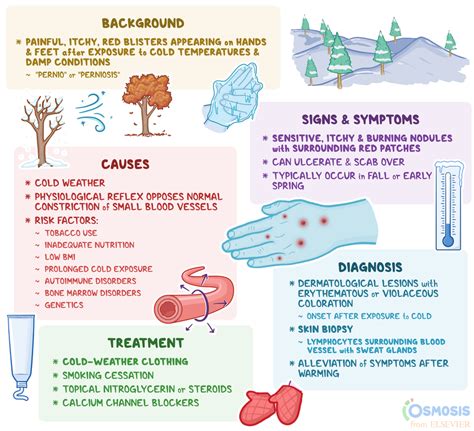 Chilblains: What Is It, Causes, Signs, Symptoms, and More | Osmosis