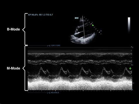 Ultrasound Physics and Technical Facts for the Beginner (2022)