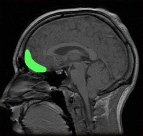 Structure of Brain Explains Ability to Regulate Emotions – Neuroscience ...