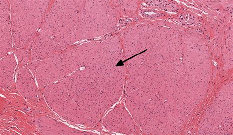 Muscle | histology