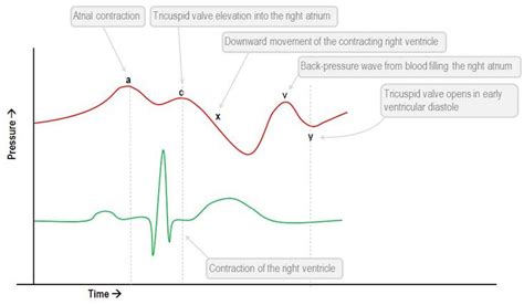 Interpretation of the central venous pressure waveform | Deranged ...