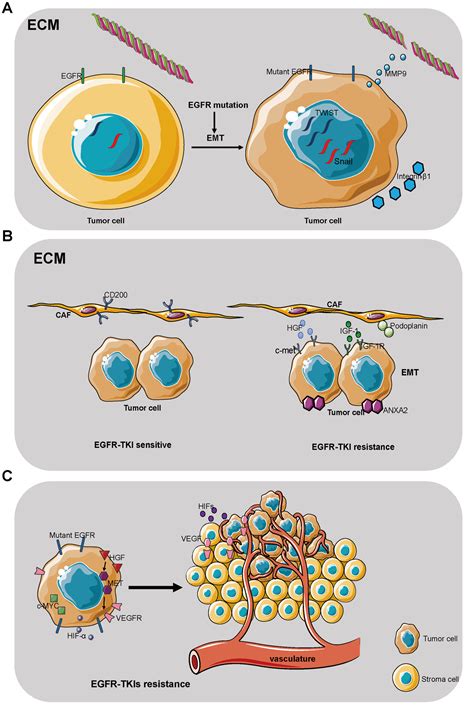 Tumor immune microenvironment in non-small cell lung cancer with EGFR mutation before and after ...