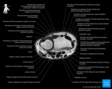 Foot Muscles Mri Anatomy : Mri Anatomy Of Ankle Radiology Case Radiopaedia Org : Neuropathies ...