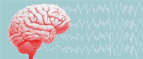 Epilepsy Brain Diagram