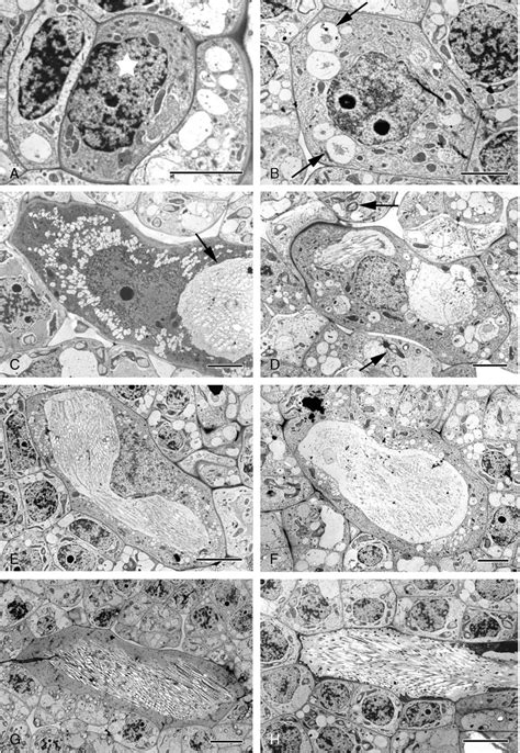 Amorphophallus variabilis, TEM micrographs of raphide idioblast... | Download Scientific Diagram