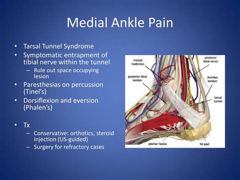 PPT - Chronic Ankle Pain PowerPoint Presentation, free download - ID ...