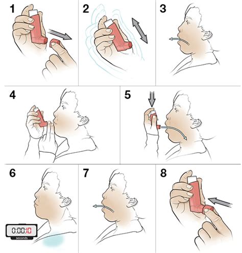 Step-by-Step: Using an Inhaler (Open Mouth) Without a Spacer