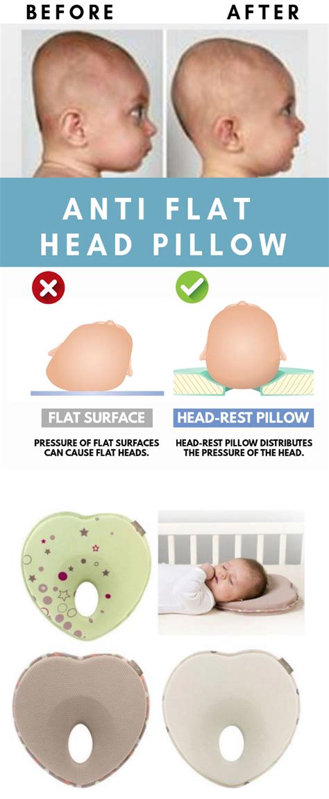 Anti Flat Head Pillow | Flat head pillow, New baby products, Head pillow