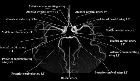 Radiology Anatomy Images : MRA Brain anatomy