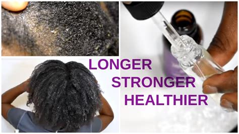 Aggregate more than 70 lavender oil for hair super hot - in.eteachers