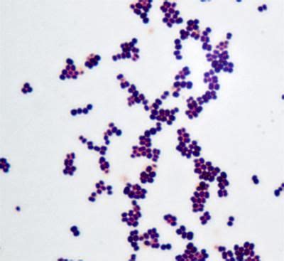 Micrococcus Luteus (With images) | Microbiology, Molecular biology ...