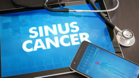 Sinus Cancer: Causes, Symptoms, and Treatment – Doctall Living