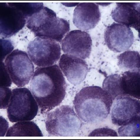 Dog-Skin-Mast cell tumour-Cytology-Metachromatic granules scale bar TB... | Download Scientific ...