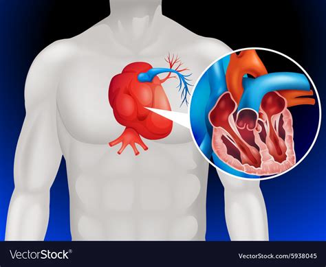 Heart disease diagram in detail Royalty Free Vector Image