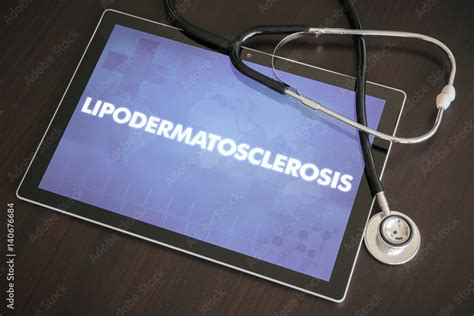 Lipodermatosclerosis (cutaneous disease) diagnosis medical concept on tablet screen with ...