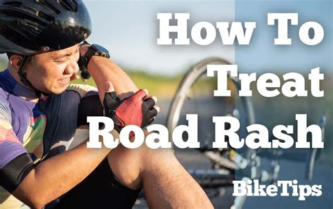 Taken A Tumble? How To Treat Road Rash