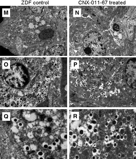 Electron microscope images of Beta cells from male ZDF and CNX-011-67 ...