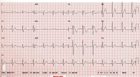 Pin su CARDIOLOGIE