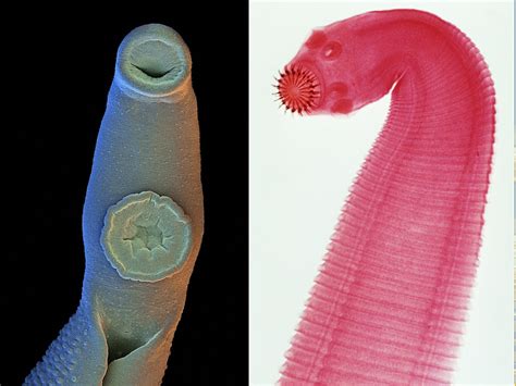 Why I'm Fascinated By Parasitic Worms | NCPR News