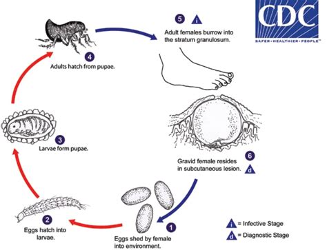 CDC - DPDx - Tungiasis