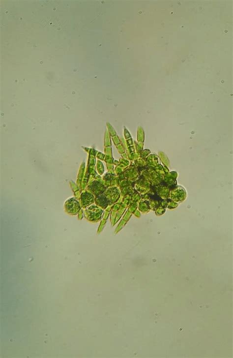 Green Algae Under Microscope