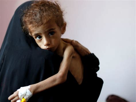 Yemen heading toward biggest famine in modern history : UN WFP - Muslim Mirror