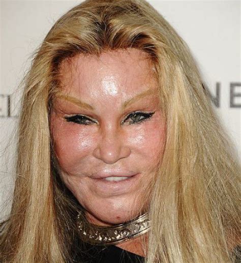 The Horrors of Terrible Plastic Surgery (40 pics) - Izismile.com