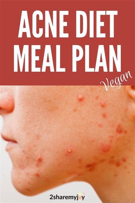 Hormonal Acne Diet Plan {best 7-day clear skin meal plan PDF} | Clear ...