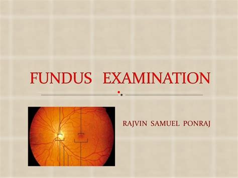 Fundus examination