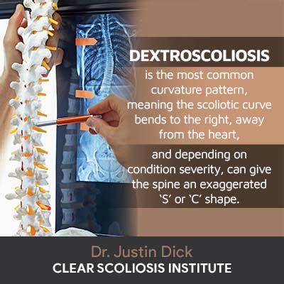 Dextroscoliosis: What Is It? Causes, Symptoms, & Treatment