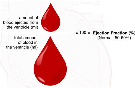 What’s a Normal Ejection Fraction for Elderly of Various Ages? » Scary ...