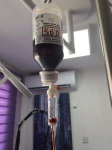 Intravenous iron infusion - Cyprus Derma Clinic