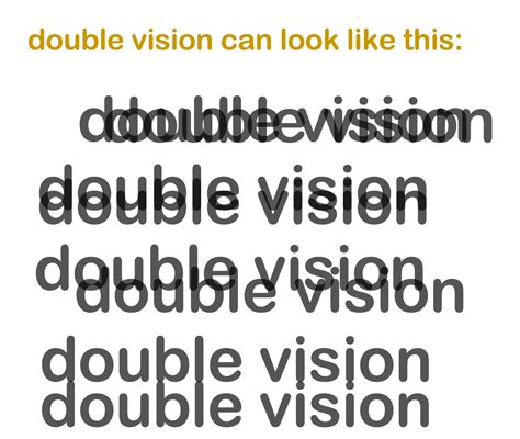 Double Vision (Diplopia): Causes, Symptoms & Treatment