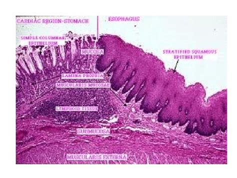 Histology Of Esophagus Gastro Esophageal Junction By Dr | SexiezPicz ...