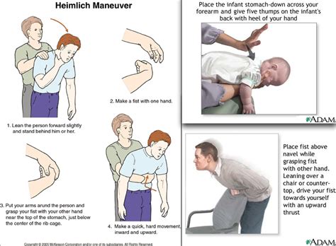 steps for the heimlich maneuver ｜ Matt's blog