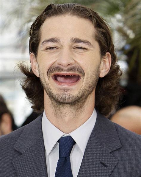 Gallery: Celebrities without teeth | Metro UK