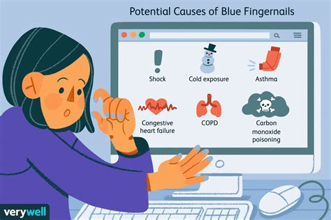 Blue Fingernails: Causes, Diagnosis, When to Seek Help