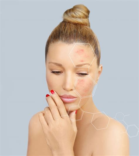 Hydroquinone For Skin: How To Use It, Benefits, & Side Effects