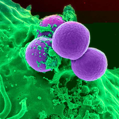 What Is A Mycoplasma Infection And What Are Its Symptoms?